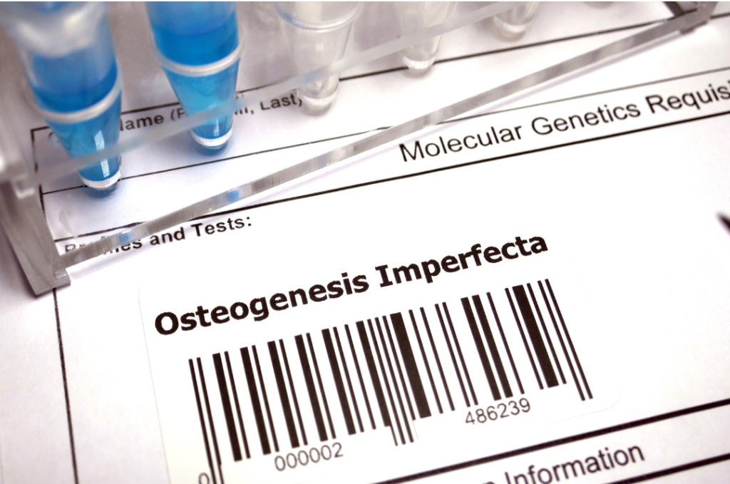 Immagine di test genetico osteoegensi imperfetta